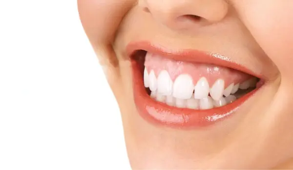 بوتكس الابتسامة اللثوية