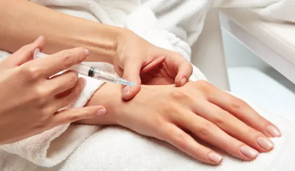 فيلر اليدين