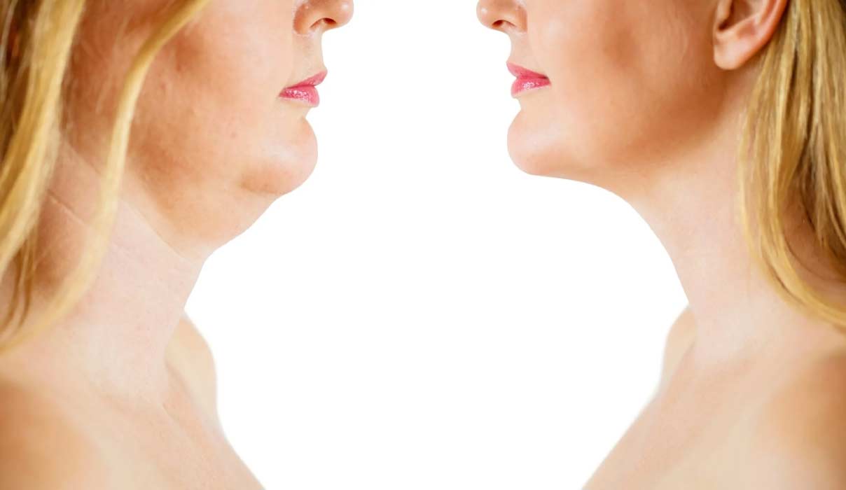 gıdı lipo gıdı lipo