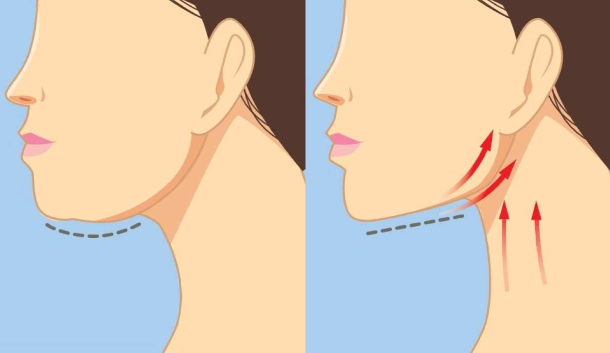 gıdı lipo gıdı lipo