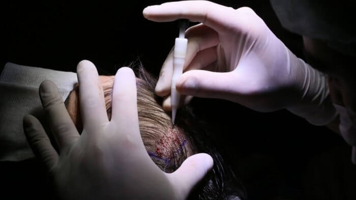 dhi-hair- dhi-hair-