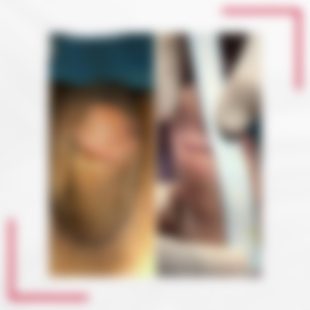 1 blurred