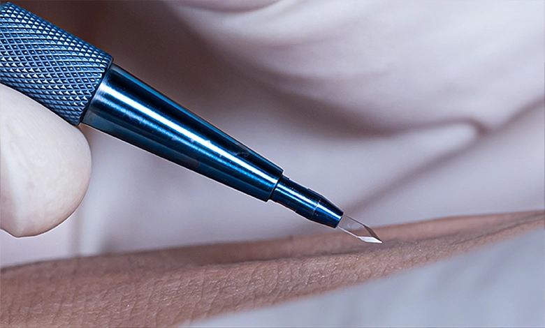 Sapphire Hair Transplant