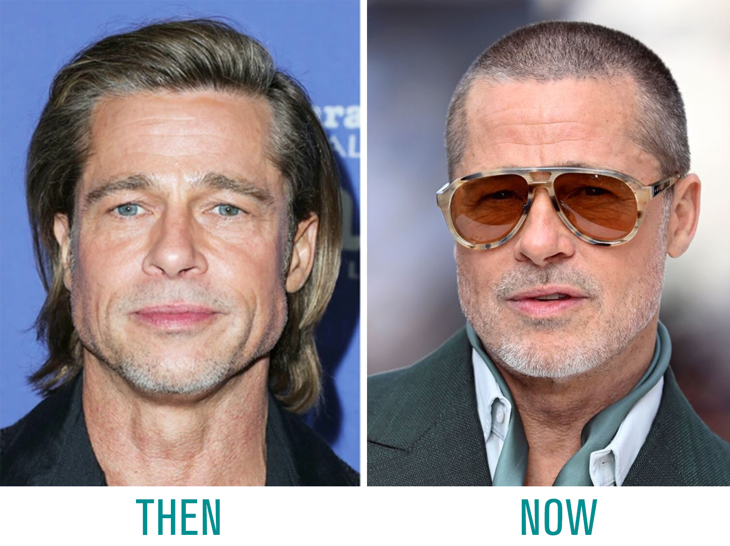 Brad Pitt Before and After Facelift Brad Pitt Before and After Facelift in 2025