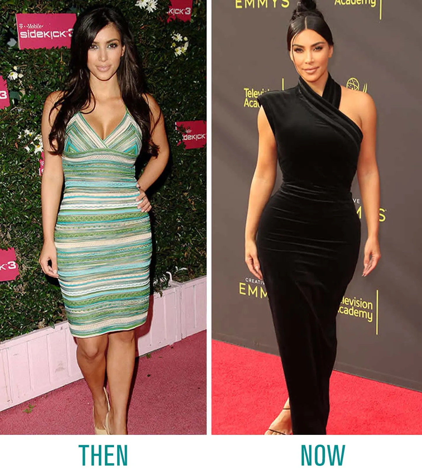 Kim Kardashian BBL