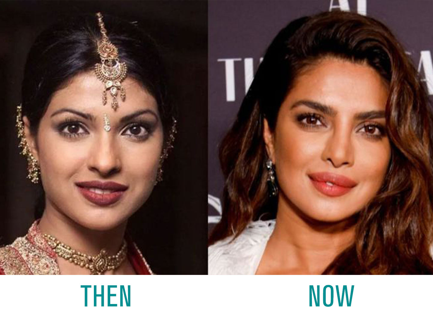 Priyanka-Chopra-Nose-Job Priyanka Chopra Nose Job
