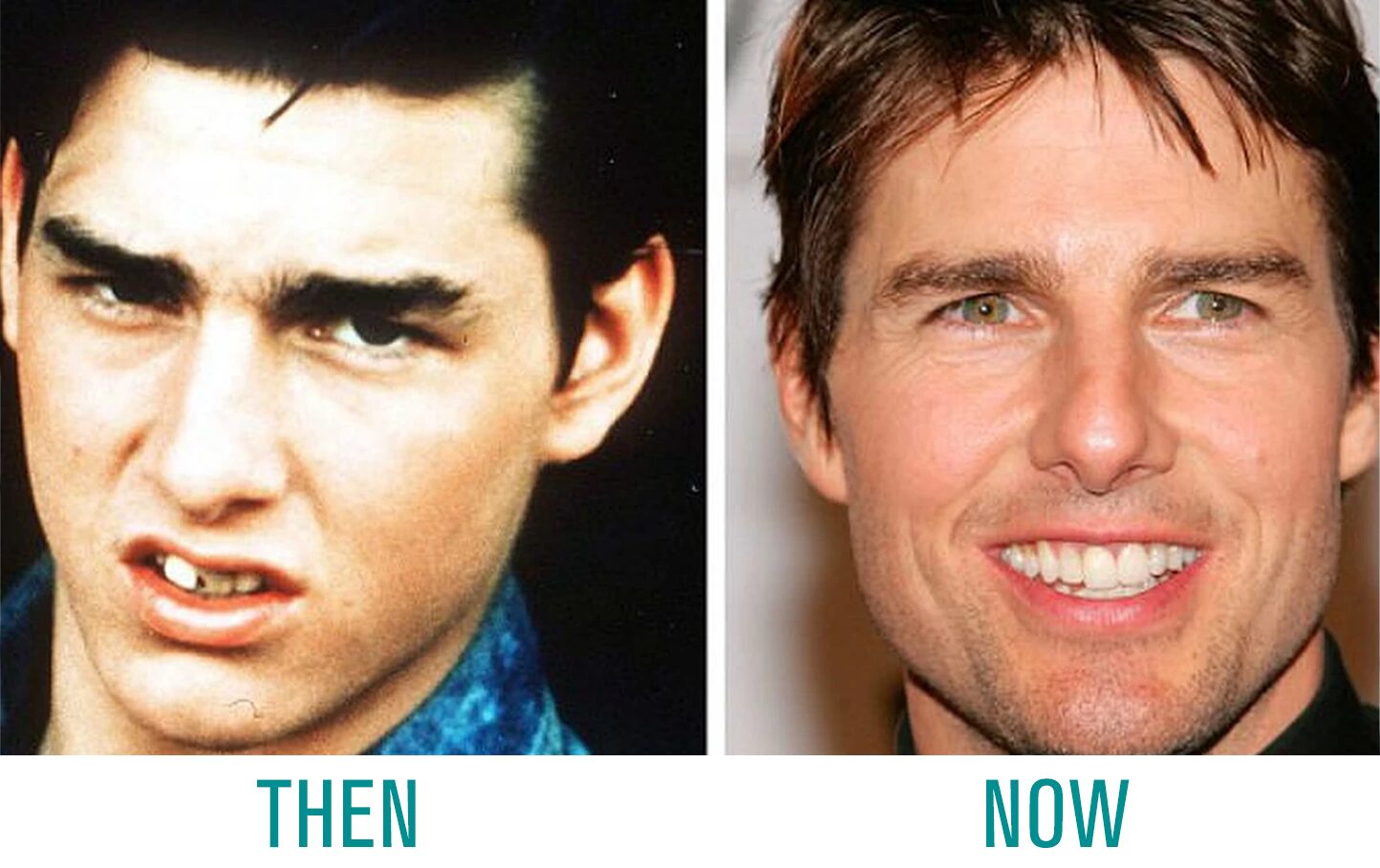 Tom Cruise Teeth Tom Cruise Teeth