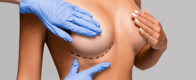 inverted nipple