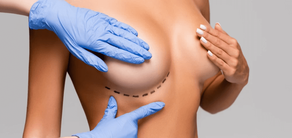 inverted nipple